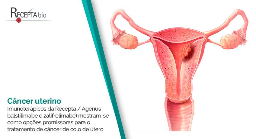 Imunoterápicos Recepta / Agenus: opções promissoras para o tratamento de câncer uterino.